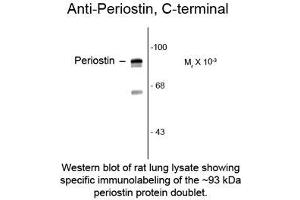Image no. 1 for anti-Periostin (POSTN) antibody (ABIN962209) (Periostin antibody)