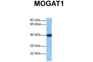 Host:  Rabbit  Target Name:  MOGAT1  Sample Tissue:  Human Fetal Liver  Antibody Dilution:  1. (MOGAT1 antibody  (C-Term))