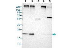 Western blot analysis of Lane 1: RT-4, Lane 2: U-251 MG, Lane 3: Human Plasma, Lane 4: Liver, Lane 5: Tonsil with MPDU1 polyclonal antibody  at 1:250-1:500 dilution.