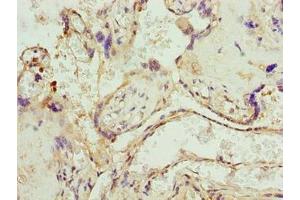 Immunohistochemistry of paraffin-embedded human placenta tissue using ABIN7174587 at dilution of 1:100 (UBXN1 antibody  (AA 1-280))