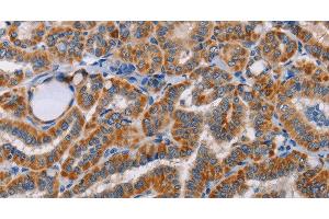 Immunohistochemistry of paraffin-embedded Human brain tissue using ALG9 Polyclonal Antibody at dilution 1:60 (ALG9 antibody)