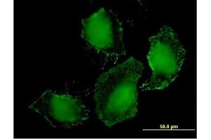 Immunofluorescence of monoclonal antibody to TLR9 on HeLa cell. (TLR9 antibody  (AA 99-215))