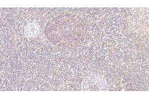 Detection of MMP7 in Human Spleen Tissue using Monoclonal Antibody to Matrix Metalloproteinase 7 (MMP7) (MMP7 antibody  (AA 18-267))