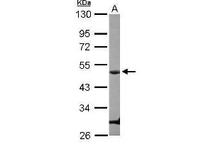 WB Image Sample (30 ug of whole cell lysate) A: U87-MG 10% SDS PAGE antibody diluted at 1:1000 (Cyclin E1 antibody  (C-Term))