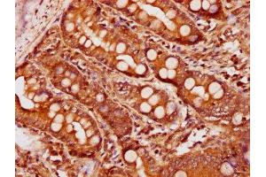 IHC image of ABIN7145692 diluted at 1:600 and staining in paraffin-embedded human small intestine tissue performed on a Leica BondTM system.