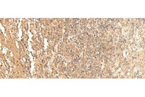 Immunohistochemistry of paraffin-embedded Human tonsil tissue using GTF3A Polyclonal Antibody at dilution of 1:60(x200) (GTF3A antibody)
