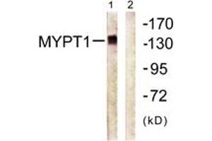 Western Blotting (WB) image for anti-Myosin Phosphatase, Target Subunit 1 (PPP1R12A) (AA 661-710) antibody (ABIN2888677) (PPP1R12A antibody  (AA 661-710))