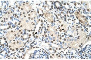 Human kidney; AKAP8L antibody - C-terminal region in Human kidney cells using Immunohistochemistry