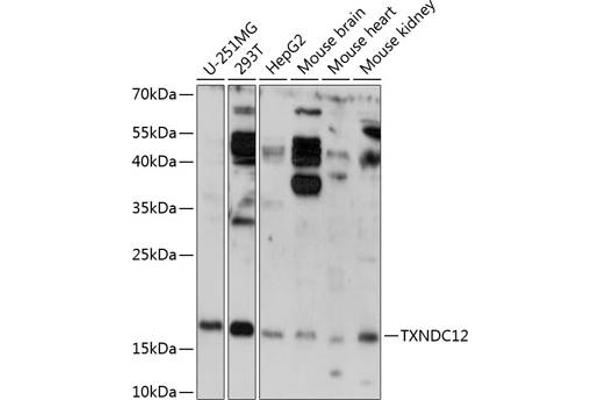 TXNDC12 antibody  (AA 93-172)