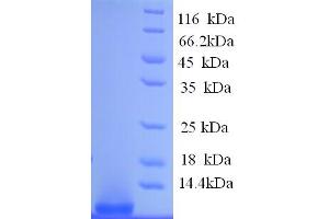 SDS-PAGE (SDS) image for Glucosidase, Beta, Acid (GBA) (AA 53-89) protein (His tag) (ABIN5713466) (GBA Protein (AA 53-89) (His tag))