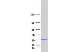 Validation with Western Blot