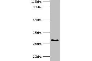 Western blot All lanes: HOXA6 antibody at 2 μg/mL + Mouse heart tissue Secondary Goat polyclonal to rabbit IgG at 1/10000 dilution Predicted band size: 27 kDa Observed band size: 27 kDa