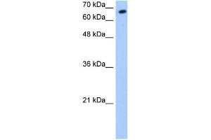 WB Suggested Anti-SYVN1 Antibody Titration:  0.