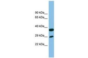 Image no. 1 for anti-Receptor (Chemosensory) Transporter Protein 4 (RTP4) (AA 107-156) antibody (ABIN6745178)