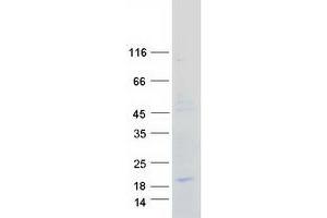 Western Blotting (WB) image for Chemokine (C-C Motif) Ligand 21 (CCL21) protein (Myc-DYKDDDDK Tag) (ABIN2714241)