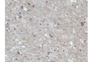 Detection of PCDHa1 in Human Cerebrum Tissue using Polyclonal Antibody to Protocadherin Alpha 1 (PCDHa1) (PCDHA1 antibody  (AA 30-242))
