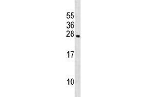 Prolactin antibody western blot analysis in 293 lysate. (Prolactin antibody  (AA 48-76))