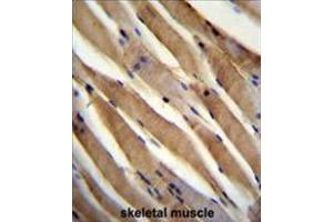 USP50 Antibody (Center) immunohistochemistry analysis in formalin fixed and paraffin embedded human skeletal muscle followed by peroxidase conjugation of the secondary antibody and DAB staining. (USP50 antibody  (Middle Region))