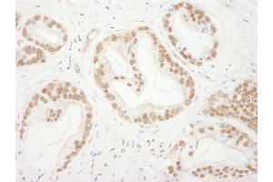 Immunohistochemistry (IHC) image for anti-Budding Uninhibited By Benzimidazoles 3 Homolog (Yeast) (BUB3) (AA 275-325) antibody (ABIN7449397) (BUB3 antibody  (AA 275-325))