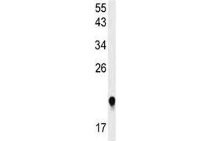 IMP3 Antikörper  (AA 156-184)