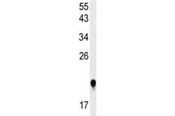IMP3 Antikörper  (AA 156-184)