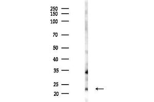 anti-Claudin 17 (CLDN17) (C-Term) antibody