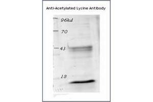 Image no. 2 for anti-Acetylated Lysine (acetylated) antibody (ABIN264880) (Acetylated Lysine antibody  (acetylated))