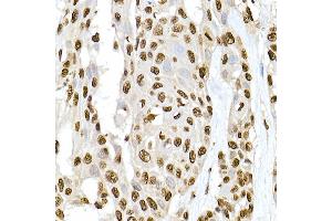 Immunohistochemistry of paraffin-embedded rat lung using XRCC2 Rabbit pAb  at dilution of 1:50 (40x lens). (XRCC2 antibody)