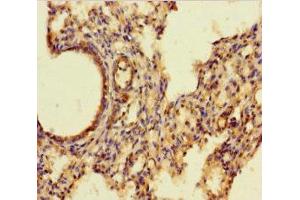 Immunohistochemistry of paraffin-embedded human lung tissue using ABIN7143728 at dilution of 1:100 (Iba1 antibody  (AA 2-147))