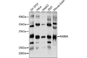 Western blot analysis of extracts of various cell lines, using RA antibody (ABIN7269818) at 1:1000 dilution. (RAB9A antibody  (AA 1-201))