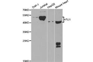 Western blot analysis of extracts of various cell lines, using FLI1 antibody (ABIN5973290) at 1/1000 dilution. (FLI1 antibody)
