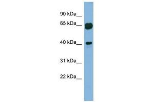 RAB3IL1 antibody used at 1 ug/ml to detect target protein. (RAB3IL1 antibody)