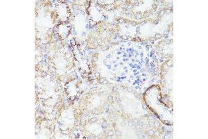 Immunohistochemistry of paraffin-embedded mouse kidney using ErbB2 antibody. (ErbB2/Her2 antibody  (C-Term))