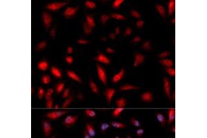 Immunofluorescence analysis of U2OS cells using Phospho-HSPB1(S82) Polyclonal Antibody