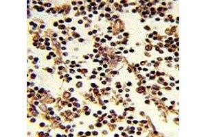 IHC analysis of FFPE human lymph stained with CD19 antibody (CD19 antibody  (AA 143-172))