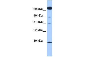 DYNLL2 antibody used at 1 ug/ml to detect target protein. (DYNLL2 antibody  (N-Term))