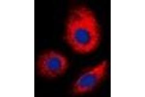 Immunofluorescent analysis of ERGIC3 staining in MCF7 cells. (ERGIC3 antibody  (C-Term))