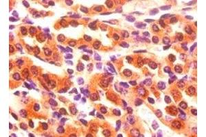 Immunohistochemistry of paraffin-embedded mouse kidney tissue using ABIN7152629 at dilution of 1:50 (FABP3 antibody  (AA 2-133))