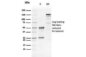 SDS-PAGE Analysis Purified GATA-3 Mouse Monoclonal Antibody (GATA3/2441). (GATA3 antibody  (AA 357-436))