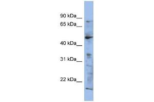 WB Suggested Anti-RAB3IP Antibody Titration: 0. (RAB3IP antibody  (N-Term))