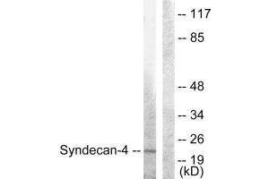 Western blot analysis of extracts from HepG2 cells, using Syndecan4 (Ab-179) antibody. (SDC4 antibody  (Ser179))