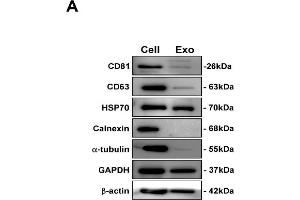 Western Blotting (WB) image for anti-CD81 (CD81) antibody (ABIN2855163)