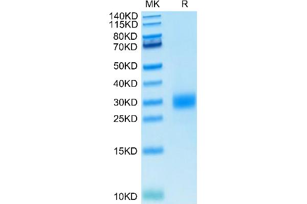 CTLA4 Protein (AA 36-161) (His tag)