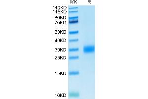 Human CTLA-4 on Tris-Bis PAGE under reduced condition. (CTLA4 Protein (AA 36-161) (His tag))