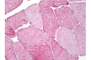 Anti-EOMES antibody IHC of human skeletal muscle. (EOMES antibody)