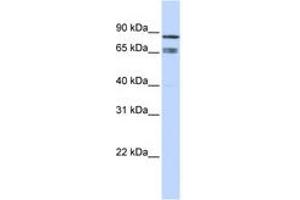 Image no. 1 for anti-IKAROS Family Zinc Finger 1 (Ikaros) (IKZF1) (AA 252-301) antibody (ABIN6742212) (IKZF1 antibody  (AA 252-301))