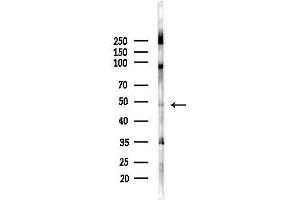 anti-Neurogenic Differentiation 2 (NEUROD2) (Internal Region) antibody