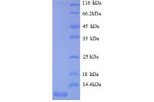 Chemokine (C-X-C Motif) Ligand 2 (CXCL2) (AA 28-100), (full length) protein (His tag) (CXCL2 Protein (AA 28-100, full length) (His tag))