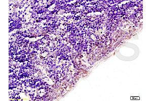 Formalin-fixed and paraffin embedded rat spleen tissue labeled with Anti-Acetyl-Histone H1b(K53) Polyclonal Antibody (ABIN729973), Unconjugated at 1:200, followed by conjugation to the secondary antibody and DAB staining (Histone H1 antibody  (acLys52))