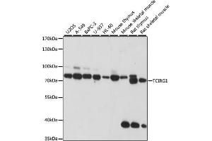 TCIRG1 antibody  (AA 1-130)